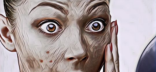 Jangan Panik, Jerat Jerawat dengan Lima Langkah Sederhana Ini!