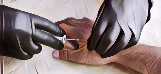 Kisah Seorang Pria yang Tanam Chip di Kedua Tangannya, untuk Apa Ya?