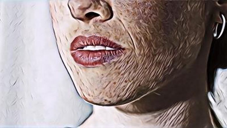 Peran Penting Vitamin D untuk Kesehatan Kulit, Mencegah Penuaan dan Jerawat