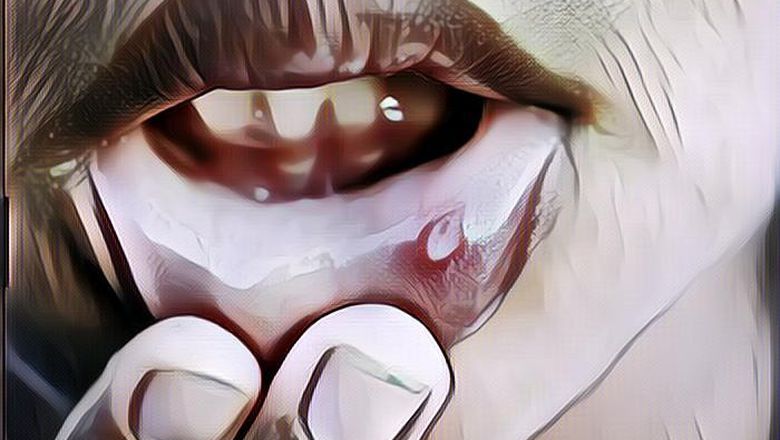 Cara Mengobati Sariawan Biar Mulutnya Enak Lagi~