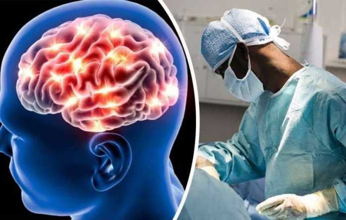 2. Menghubungkan Keseluruhan Otak dengan Sistem Operasi