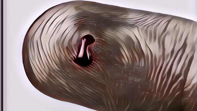 Kenapa Orang Takut Pada Darah, Malah Kadang Ada Yang Pingsan, Kamu Harus Tau