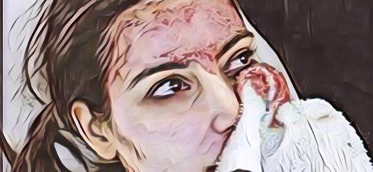 Bikin Tepok Jidat, Ini Daftar Perawatan Tubuh Unik ala Selebriti Hollywood