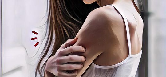 Mengenal Apa itu Prurigo atau Darah Manis, Apa Penyebab dan Bagaimana Menyembuhkannya?