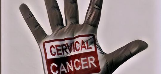 Obat Herbal Kanker Serviks, Murah Meriah dan Sangat Berkhasiat