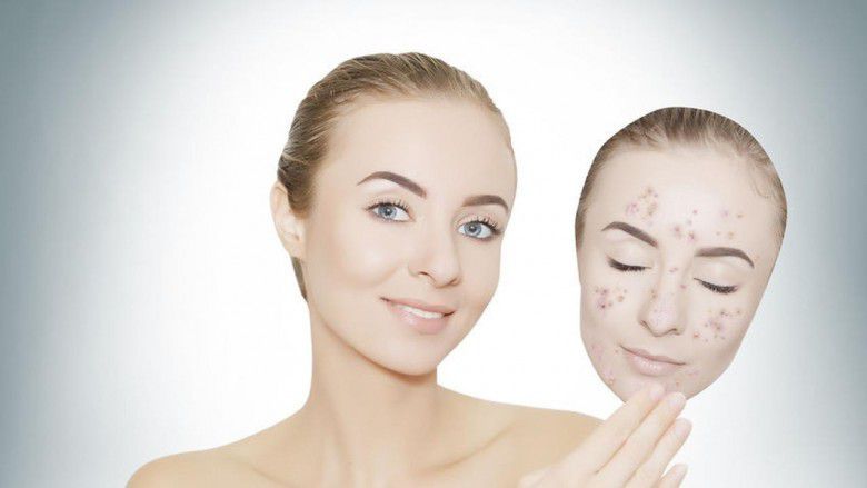 2. Menyamarkan noda hitam bekas jerawat