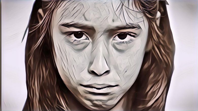 5 gejala Yang Berdampak Pada Kulit Ketika Sedang Stres