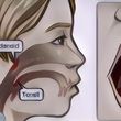 Apakah Adenoid Bisa Sembuh Sendiri?