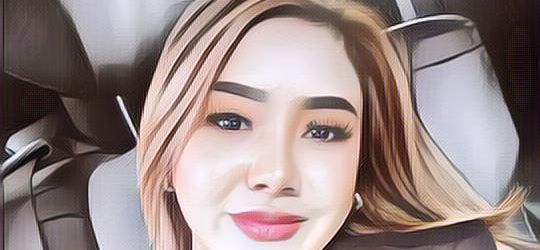 Sakit Autoimun, Cita Citata Pilih Pengobatan Alternatif Ini