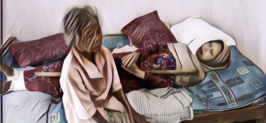 Wanita yang Dijuluki 'Manusia Kayu' Meninggal Dunia, Begini Kondisi Terakhirnya