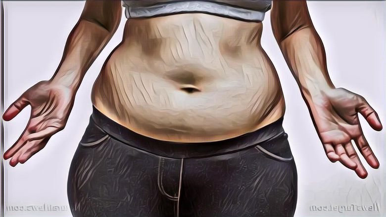 Berikut Ini Bahaya Perut Buncit dan Bagaimana Cara Mengecilkannya, Yuk Bisa Yuk Dikecilin!