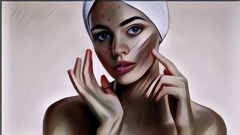 Cara Menghilangkan Jerawat dalam Satu Malam, Dijamin Ampuh!