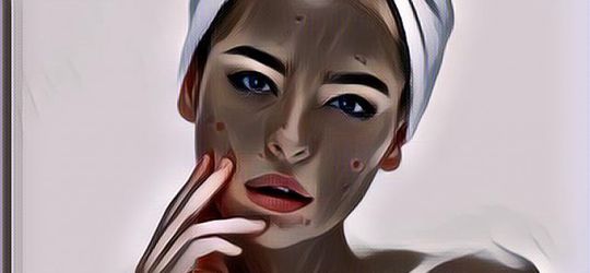 Cara Menghilangkan Bintik Hitam di Wajah yang Murah dan Alami