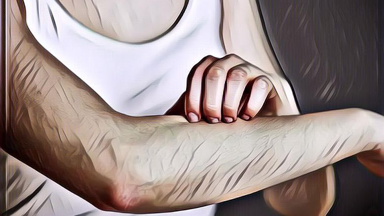 Warna Kulit Manusia yang Begini Bikin Banyak Orang Tergila-gila