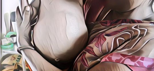 Ngeri! Wanita Ini Punya Kembaran yang Hidup di Dalam Tubuhnya