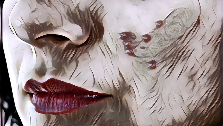 Cara Mengatasi Jerawat Batu dengan Resep Mudah Alami