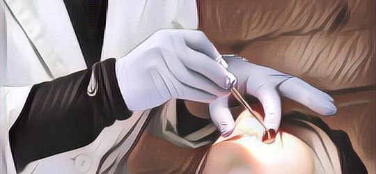 Ambisi Buat Turunkan BB, Wanita Ini Nekat Kawat Pengait Gigi Supaya Tidak Bisa Makan