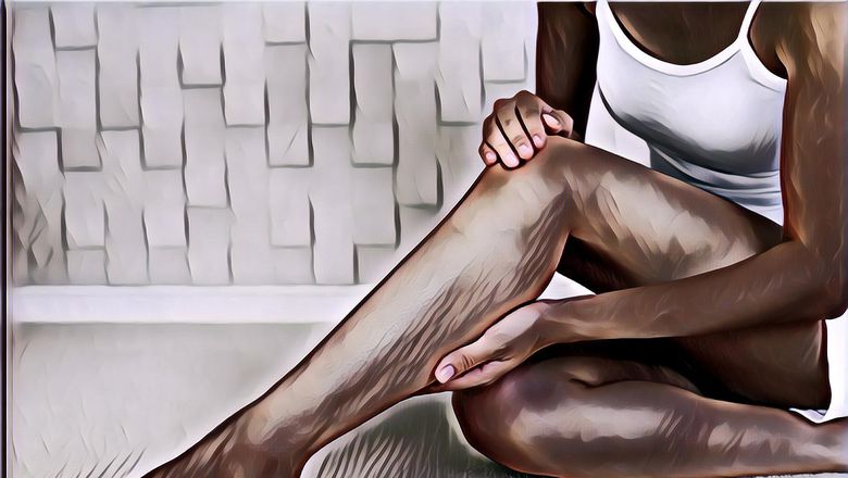 Mengenal Apa Itu Varises dan Cara Mengatasinya Menggunakan Teknologi EVLA