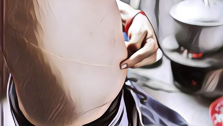 Miris Banget, 5 Pria Nepal Ini Rela Jual Ginjal dengan Harga Murah Saking BU-nya