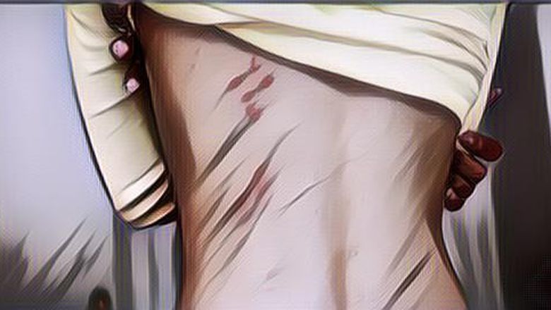 Jenis-Jenis Kutu di Dunia, Ada Apa Saja?