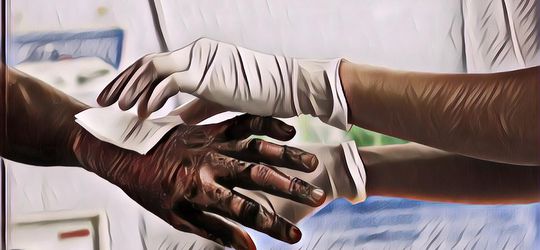 Jangan Pakai Pasta Gigi! Lakukan Ini Jika Kamu Mengalami Luka Bakar