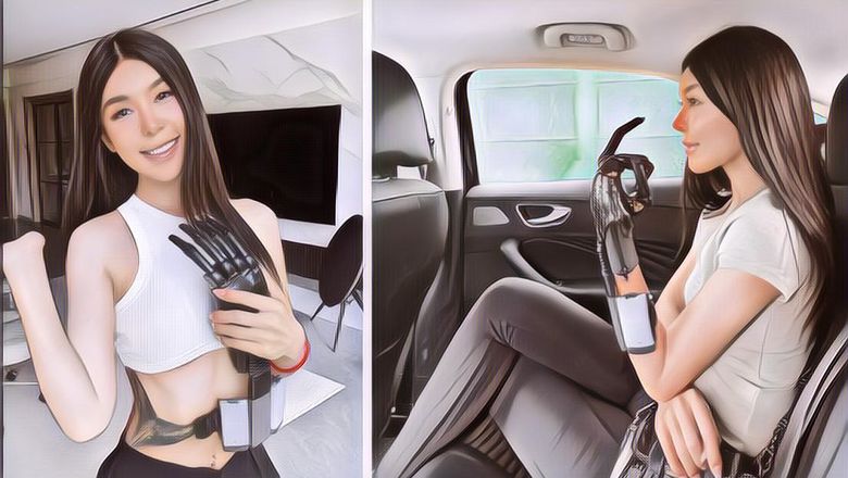 Miris, Model Cantik Ini Harus Mengamputasi Tangannya, Kini Pakai Tangan Robot