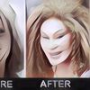 Deretan Wajah Artis yang Makin Aneh Karena Ketagihan Operasi Plastik