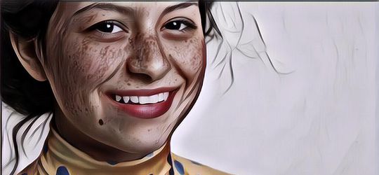 Tips-Tips Menghilangkan Flek Hitam di Wajah dengan Cepat Secara Alami