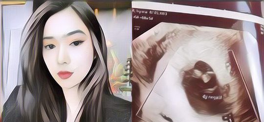 Isyana Sarasvati Keguguran, Berikut Beberapa Hal yang Bisa Menyebabkan Janin di Kandungan Berhenti Tumbuh