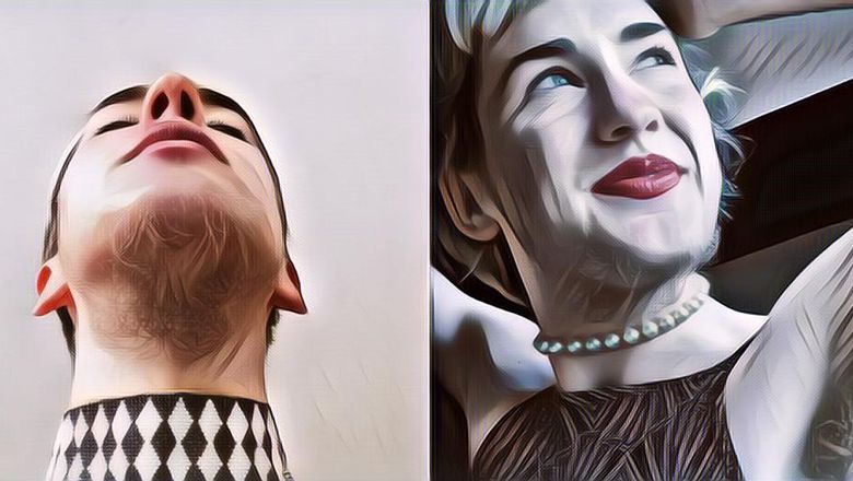 Viral Wanita Penuh Dengan Bulu, Sering Dikatakan Mirip Laki-Laki