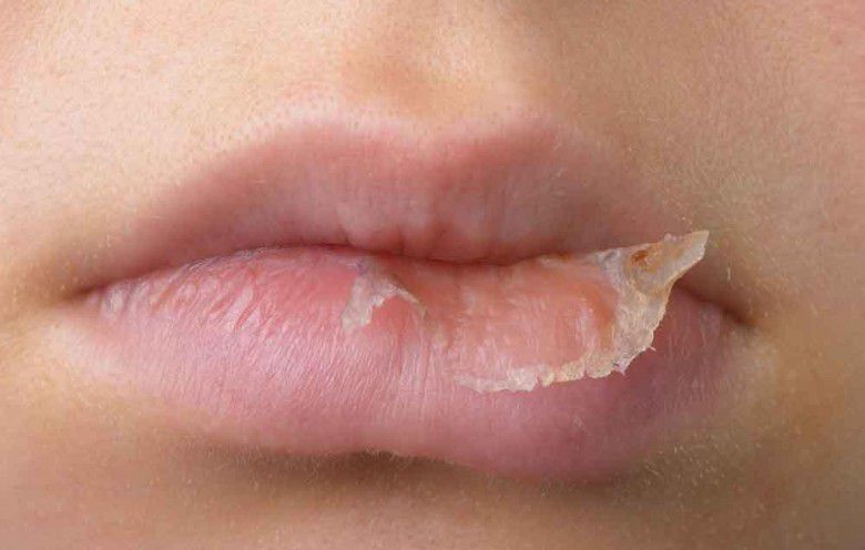 Manfaat madu untuk kecantikan bibir