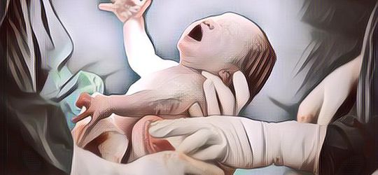 Heboh! Bayi Bermata Satu Lahir Di Yaman, Endingnya Memilukan Keluarga Harus Ikhlas