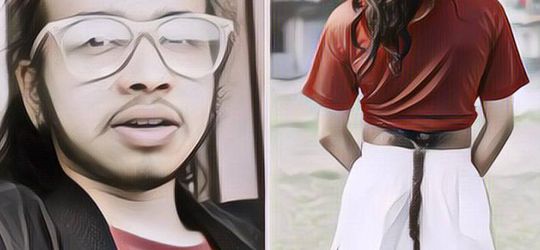 Benar-Benar Nyata! Pria Ini Punya Ekor di Tubuhnya Sepanjang 70 Cm