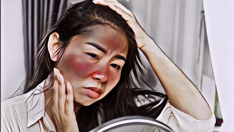 6 Bahan Alami untuk Menghilangkan Kemerahan di Wajah