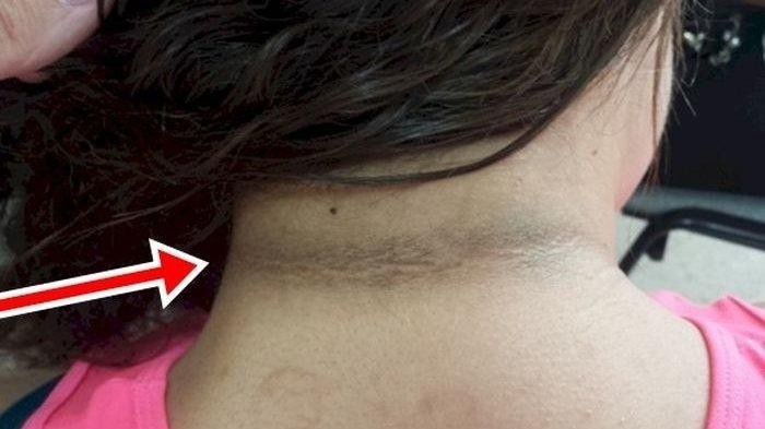 3. Beberapa Bagian Tubuh Menghitam