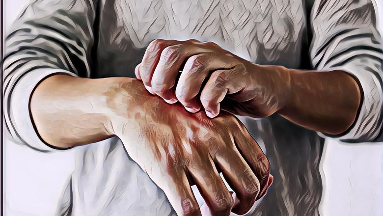 Inilah 9 Makanan Penghilang Alergi Kulit yang Patut Dicoba