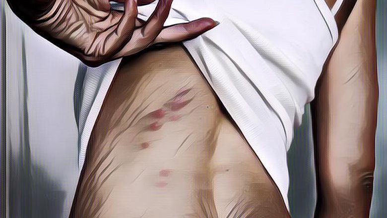 Ini Tips Cara Ampuh Membasmi Kutu Kasur, Dijamin Berhasil