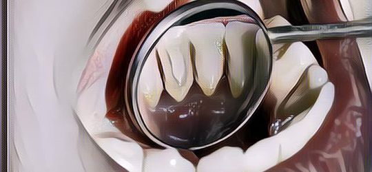 4 Bahan Alami yang Mampu Hilangkan Karang Gigi, Cobain Mumpung Lagi di Rumah Aja