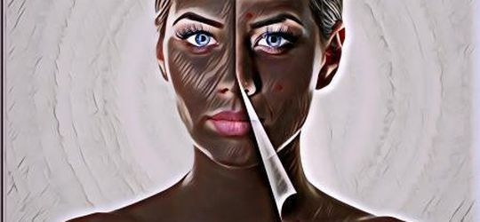 Gimana Caranya Tahu Kalau Kita Kena Kanker Kulit? Gini Ciri-Cirinya Gengs