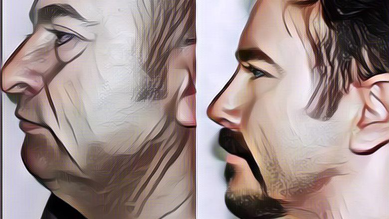 Viral Lansia yang Oplas, Hasilnya Jadi Lebih Muda 20 Tahun