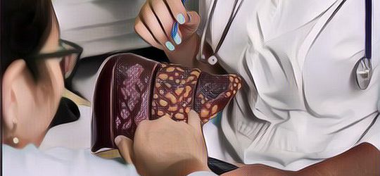 Apa itu Penyakit Sirosis Hati dan Apa Gejalanya?