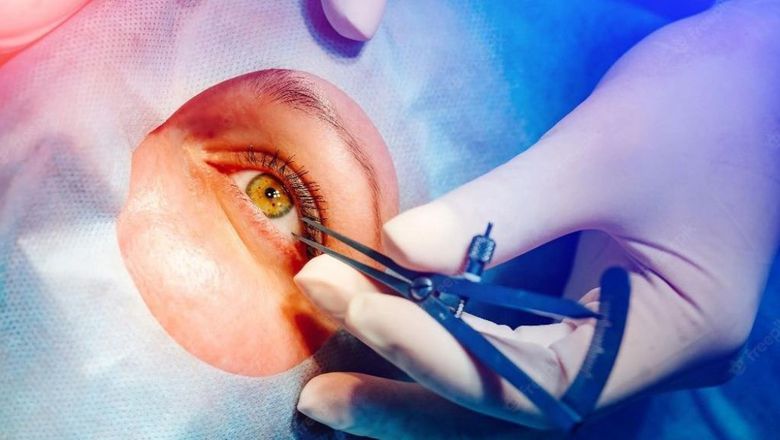 Bisa Sembuhkan Mata Minus, Ini 4 Fakta Operasi Lasik Mata yang Wajib Dipahami Pasien