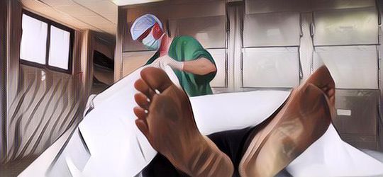 NGERI! Dokter Forensik Ini Ungkap Pengalaman Autopsi Jenazah Korban Santet yang Dipenuhi Belatung