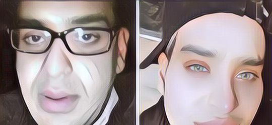 Kecanduan Oplas Demi Bisa Mirip dengan Filter IG, Wajah Pria Ini Bikin Syok