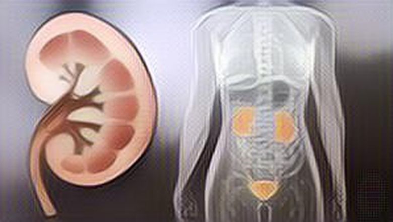 Rahasia Ginjal Sehat, Konsumsi 5 Makanan Ini!