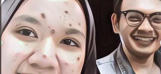 Viral Postingan Cowok Kasih Semangat Pacar yang Wajahnya Jerawatan Parah