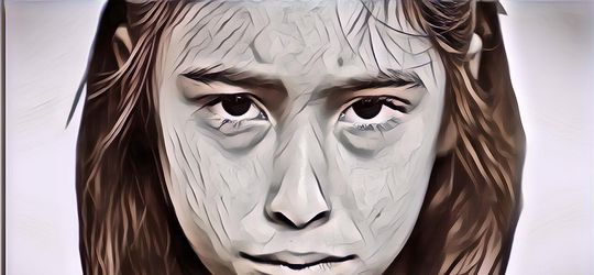 5 gejala Yang Berdampak Pada Kulit Ketika Sedang Stres