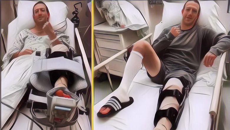 CEO Facebook Mark Zuckerberg Alami Cedera di Ligamen, Berujung Harus Operasi