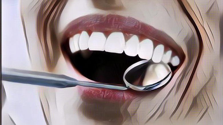 Cara Mencegah Gigi Berlubang yang Sakitnya Nggak Main-main