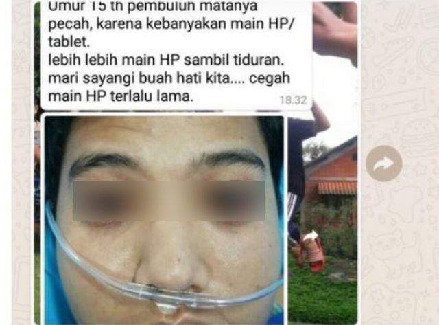 # TIDUR DAN KESEHATAN MATA